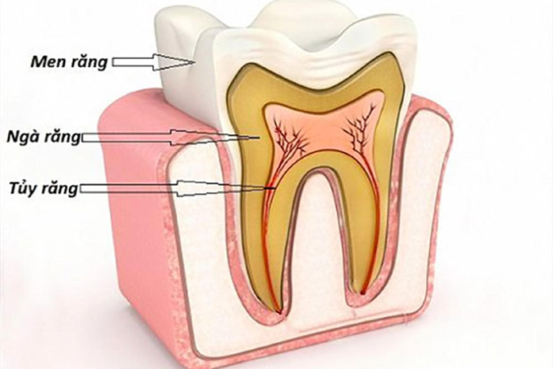 Bệnh viêm tủy răng là gì? | nha khoa Thái Tổ - Quận 10